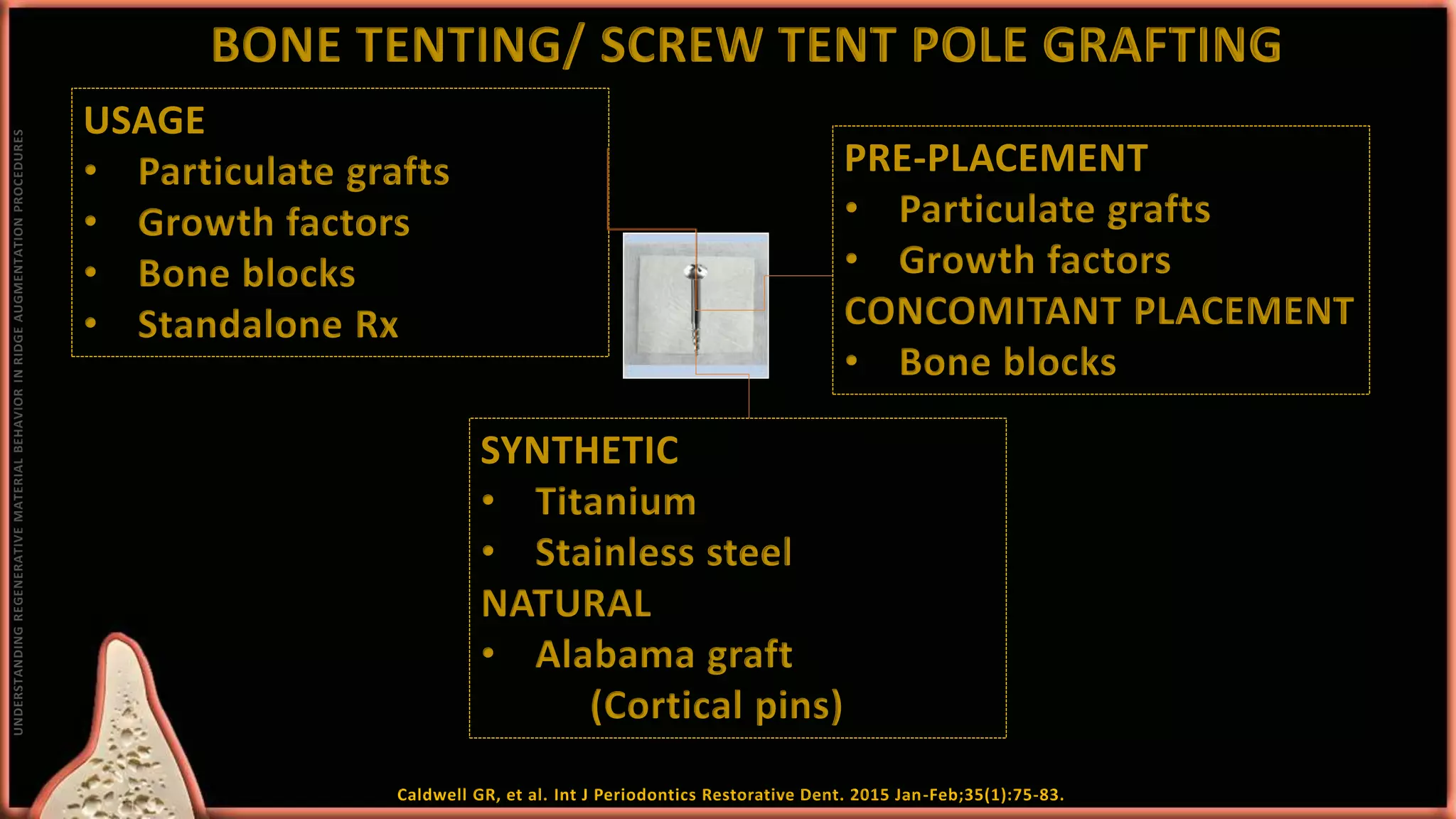 Approaches to ridge augmentation | PPTX