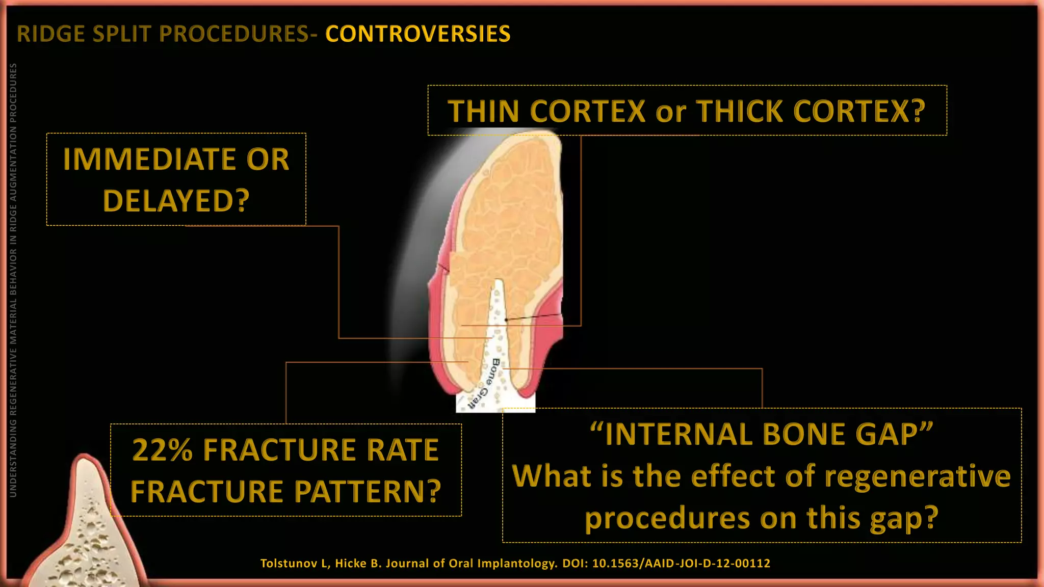 Approaches to ridge augmentation | PPTX
