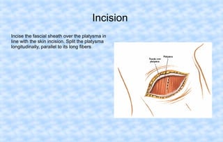 Incision
Incise the fascial sheath over the platysma in
line with the skin incision. Split the platysma
longitudinally, parallel to its long fibers

 