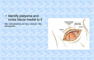 ●

Identify platysma and
incise fascia medial to it

Skin and platysma are very vascular. Use
epinephrine

 