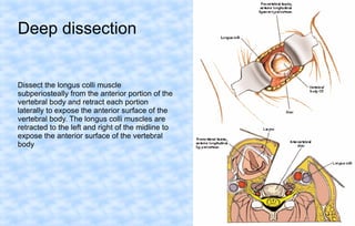 Deep dissection

Dissect the longus colli muscle
subperiosteally from the anterior portion of the
vertebral body and retract each portion
laterally to expose the anterior surface of the
vertebral body. The longus colli muscles are
retracted to the left and right of the midline to
expose the anterior surface of the vertebral
body

 