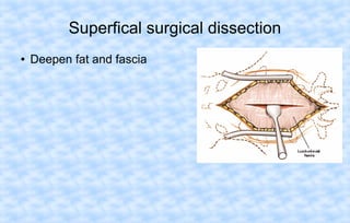 Superfical surgical dissection
●

Deepen fat and fascia

 