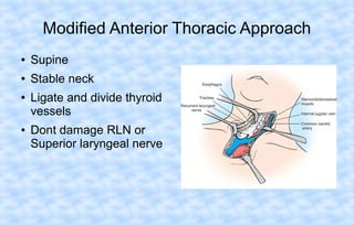 Modified Anterior Thoracic Approach
●

Supine

●

Stable neck

●

●

Ligate and divide thyroid
vessels
Dont damage RLN or
Superior laryngeal nerve

 