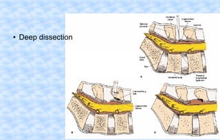 ●

Deep dissection

 