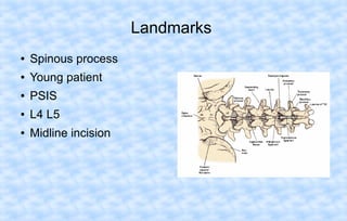 Landmarks
●

Spinous process

●

Young patient

●

PSIS

●

L4 L5

●

Midline incision

 