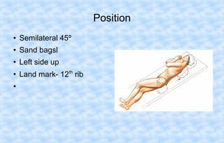 Position
●

Semilateral 45º

●

Sand bagsl

●

Left side up

●

Land mark- 12th rib

●

 