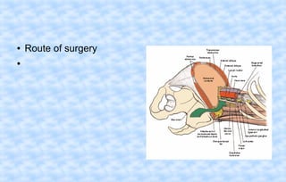 ●
●

Route of surgery

 