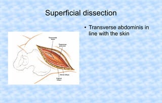 Superficial dissection
●

Transverse abdominis in
line with the skin

 
