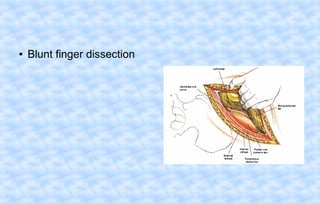●

Blunt finger dissection

 