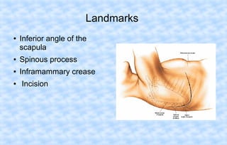 Landmarks
●

Inferior angle of the
scapula

●

Spinous process

●

Inframammary crease

●

Incision

 