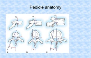Pedicle anatomy

 