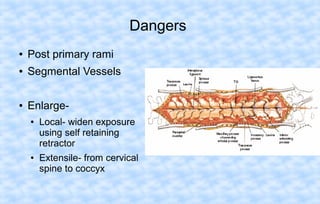 Dangers
●

Post primary rami

●

Segmental Vessels

●

Enlarge●

●

Local- widen exposure
using self retaining
retractor
Extensile- from cervical
spine to coccyx

 