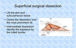 Superficial surgical dissection
●

●

●

Lift the skin and
subcutaneous tissue
Centre the dissection over
the most prominent rib
Intermediate dissectionidentify the trapezius by
the rolled border

 