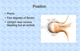 Position
●

Prone

●

Few degrees of flexion

●

Upright- less venous
bleeding but air emboli

 