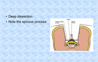 ●

Deep dissection

●

Note the spinous process

 