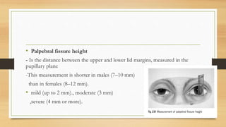• Palpebral fissure height
- Is the distance between the upper and lower lid margins, measured in the
pupillary plane
-This measurement is shorter in males (7–10 mm)
than in females (8–12 mm).
• mild (up to 2 mm)., moderate (3 mm)
,severe (4 mm or more).
 