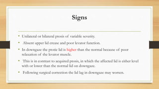 Signs
• Unilateral or bilateral ptosis of variable severity.
• Absent upper lid crease and poor levator function.
• In downgaze the ptotic lid is higher than the normal because of poor
relaxation of the levator muscle.
• This is in contrast to acquired ptosis, in which the affected lid is either level
with or lower than the normal lid on downgaze.
• Following surgical correction the lid lag in downgaze may worsen.
 