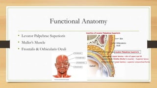 Functional Anatomy
• Levator Palpebrae Superioris
• Muller’s Muscle
• Frontalis & Orbicularis Oculi
 