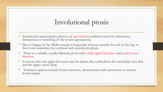 Involutional ptosis
• Involutional (aponeurotic) ptosis is an age-related condition caused by dehiscence,
disinsertion or stretching of the levator aponeurosis.
• Due to fatigue of the Müller muscle it frequently worsens towards the end of the day, so
that it can sometimes be confused with myasthenic ptosis.
• There is a variable, usually bilateral, ptosis with a high upper lid crease and good levator
function.
• In severe cases the upper lid crease may be absent, the eyelid above the tarsal plate very thin
and the upper sulcus deep.
• Treatment options include levator resection, advancement with reinsertion or anterior
levator repair.
 