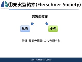 Kameda Medical Center
①充実型結節(Fleischner Society)
充実型結節
多発単発
特徴：結節の個数により分類する
 