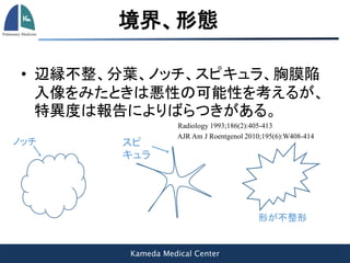 Kameda Medical Center
境界、形態
• 辺縁不整、分葉、ノッチ、スピキュラ、胸膜陥
入像をみたときは悪性の可能性を考えるが、
特異度は報告によりばらつきがある。
Radiology 1993;186(2):405-413
AJR Am J Roentgenol 2010;195(6):W408-414
 