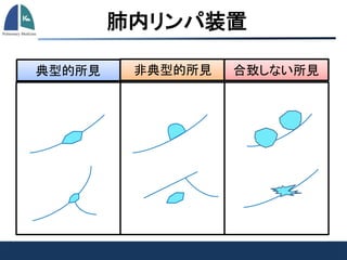 典型的所見 非典型的所見 合致しない所見
肺内リンパ装置
 