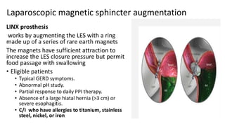 Approach, indications and surgical management of gerd 2 | PPTX