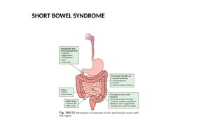 SHORT BOWEL SYNDROME
 