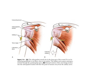 Surgical Approach to Shoulder & Elbow | PPTX