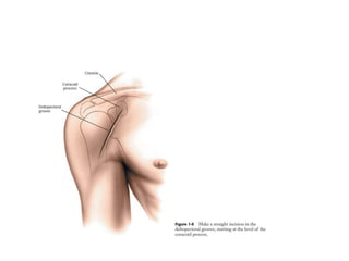 Surgical Approach to Shoulder & Elbow | PPTX