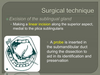 Sublabial Excision Approach to Salivary Glands | PPTX