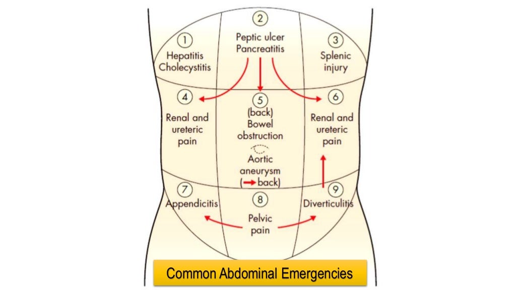 Lower Abdominal Pain In The Emergency Department Manu - vrogue.co