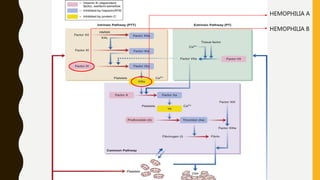 HEMOSTASIS HEMOPHILIA A
HEMOPHILIA B
 