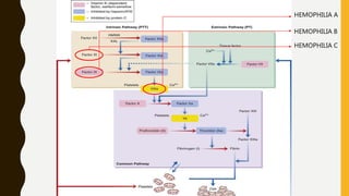 HEMOSTASIS HEMOPHILIA A
HEMOPHILIA B
HEMOPHILIA C
 