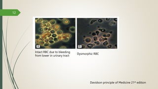 Approach to abnormal RENAL FUNCTION TEST.pptx