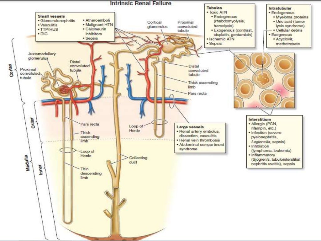 Approach to a case of aki