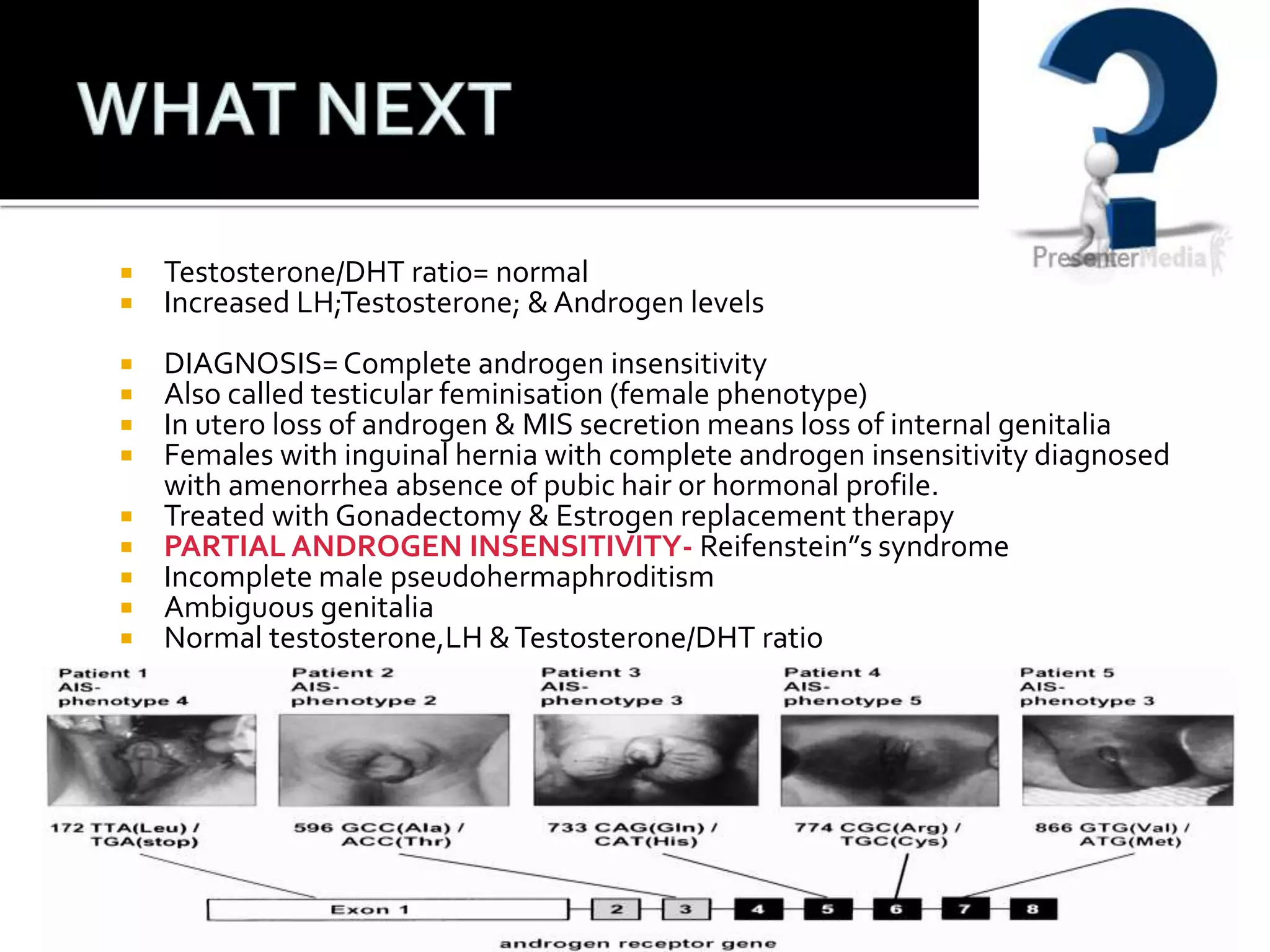  Testosterone/DHT ratio= normal 
 Increased LH;Testosterone; & Androgen levels 
 DIAGNOSIS= Complete androgen insensitivity 
 Also called testicular feminisation (female phenotype) 
 In utero loss of androgen & MIS secretion means loss of internal genitalia 
 Females with inguinal hernia with complete androgen insensitivity diagnosed 
with amenorrhea absence of pubic hair or hormonal profile. 
 Treated with Gonadectomy & Estrogen replacement therapy 
 PARTIAL ANDROGEN INSENSITIVITY- Reifenstein”s syndrome 
 Incomplete male pseudohermaphroditism 
 Ambiguous genitalia 
 Normal testosterone,LH & Testosterone/DHT ratio 
 