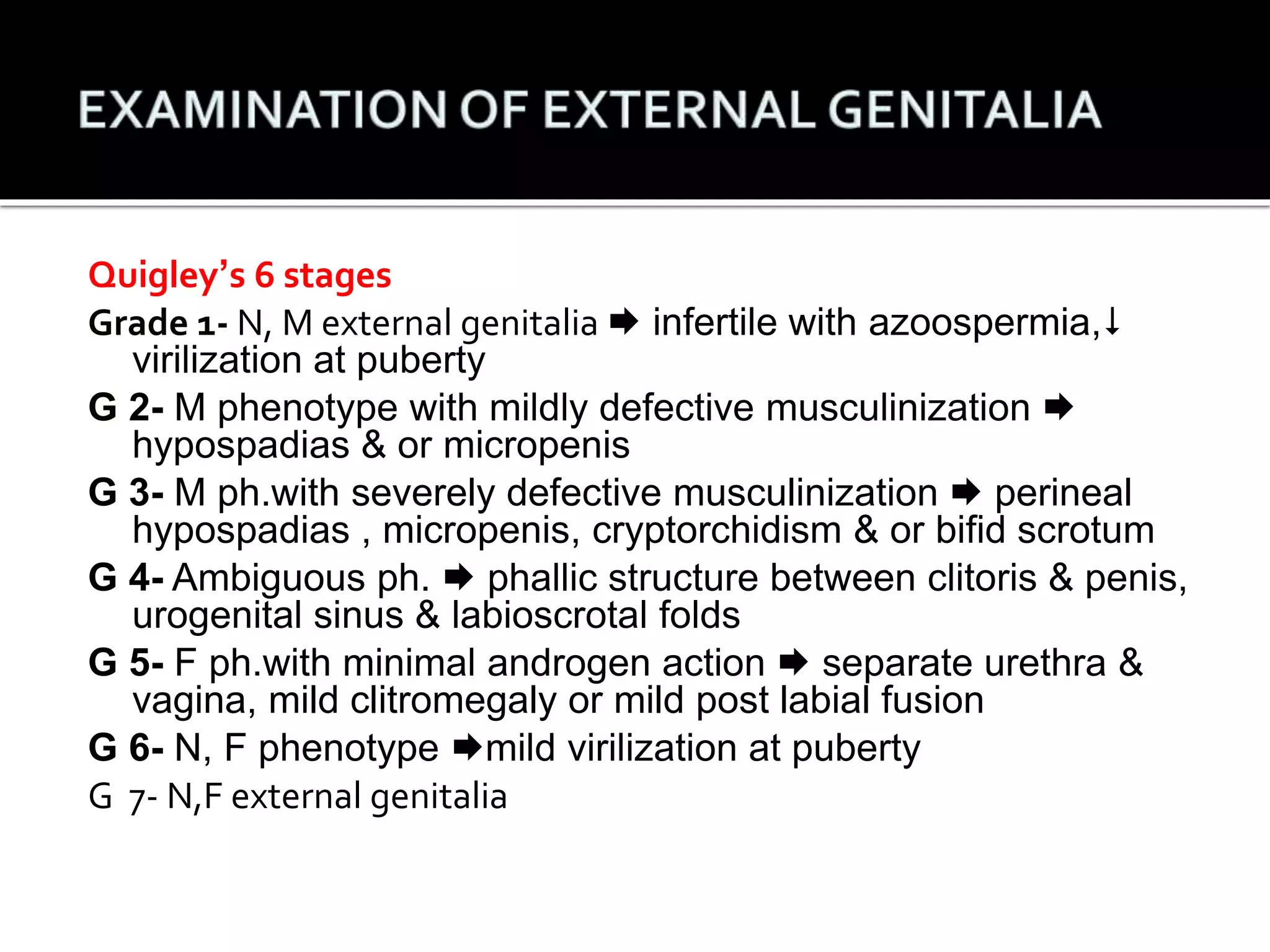 Quigley’s 6 stages 
Grade 1- N, M external genitalia  infertile with azoospermia, 
virilization at puberty 
G 2- M phenotype with mildly defective musculinization  
hypospadias & or micropenis 
G 3- M ph.with severely defective musculinization  perineal 
hypospadias , micropenis, cryptorchidism & or bifid scrotum 
G 4- Ambiguous ph.  phallic structure between clitoris & penis, 
urogenital sinus & labioscrotal folds 
G 5- F ph.with minimal androgen action  separate urethra & 
vagina, mild clitromegaly or mild post labial fusion 
G 6- N, F phenotype mild virilization at puberty 
G 7- N,F external genitalia 
 