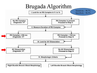 Approach to a case of wide complex tachycardia | PPTX