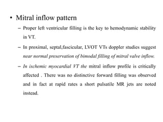 Mitral Inflow Letters Approach to a case of wide complex tachycardia | PPTX
