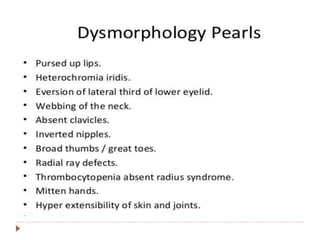 Approach to a child with dysmorphism | PPTX