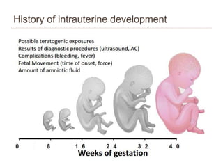 Approach to a child with dysmorphism | PPTX
