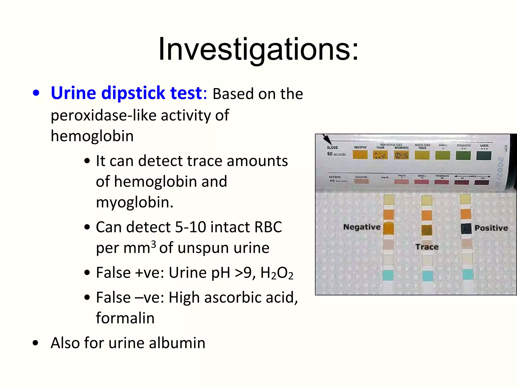 Investigations:
• Urine dipstick test: Based on the
  peroxidase-like activity of
  hemoglobin
       • It can detect trace amounts
         of hemoglobin and
         myoglobin.
       • Can detect 5-10 intact RBC
         per mm3 of unspun urine
       • False +ve: Urine pH >9, H2O2
       • False –ve: High ascorbic acid,
         formalin
• Also for urine albumin
 