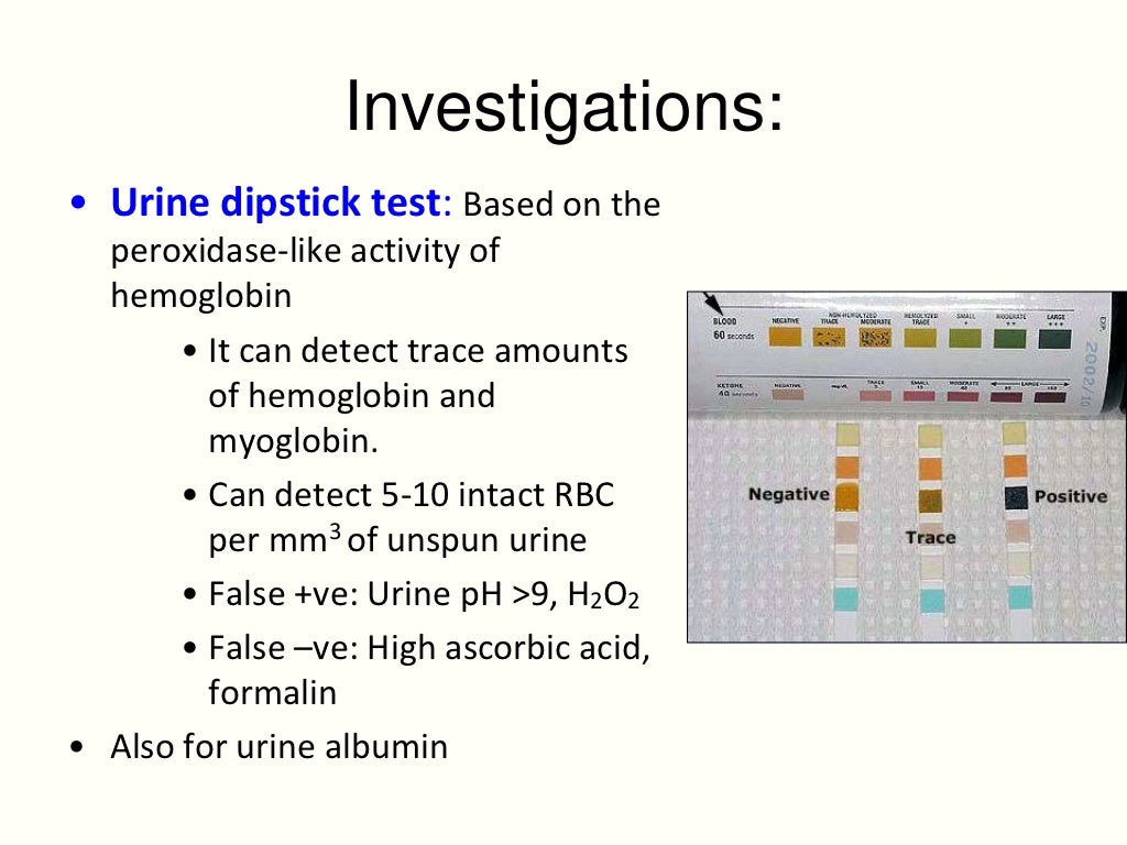 Approach to a child with hematuria