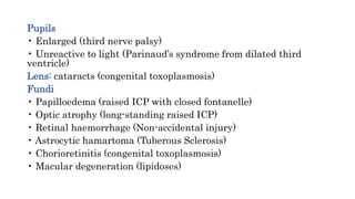 Pupils
• Enlarged (third nerve palsy)
• Unreactive to light (Parinaud’s syndrome from dilated third
ventricle)
Lens: cataracts (congenital toxoplasmosis)
Fundi
• Papilloedema (raised ICP with closed fontanelle)
• Optic atrophy (long-standing raised ICP)
• Retinal haemorrhage (Non-accidental injury)
• Astrocytic hamartoma (Tuberous Sclerosis)
• Chorioretinitis (congenital toxoplasmosis)
• Macular degeneration (lipidoses)
 