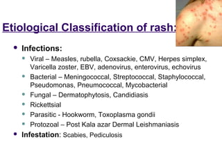 Approach to a_child_with_rash[1] | PPT