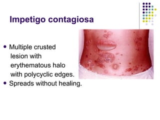 Approach to a_child_with_rash[1] | PPT