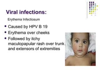 Approach to a_child_with_rash[1] | PPT