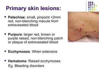Approach to a_child_with_rash[1] | PPT