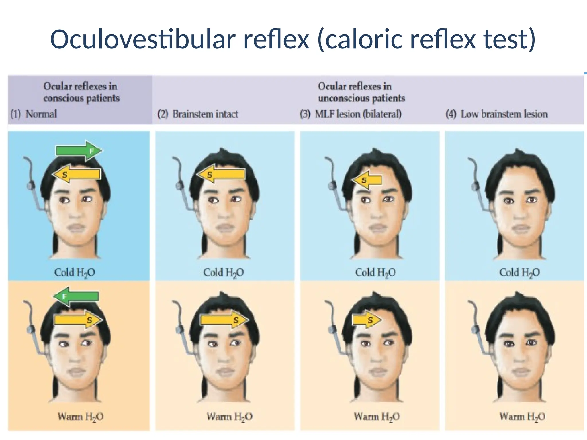 Approach_ to_ a comatos patient........pptx